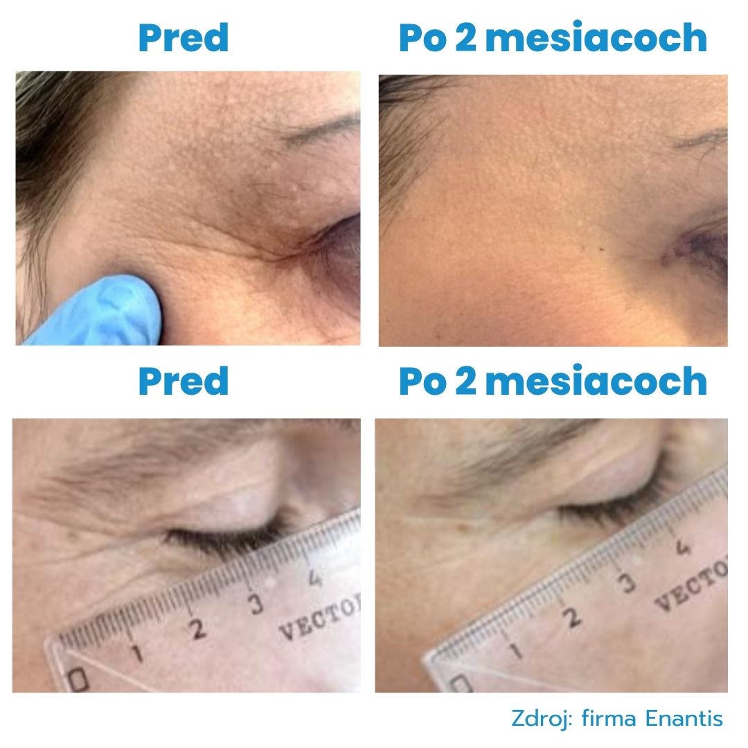 Growth serum1